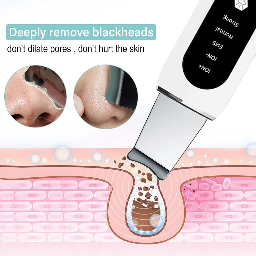 Peicon profesjonalny ultradźwiękowy peeling do twarzy – głębokie oczyszczanie i złuszczanie