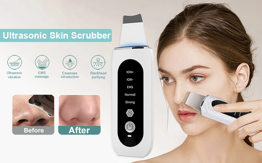 Peicon profesjonalny ultradźwiękowy peeling do twarzy – głębokie oczyszczanie i złuszczanie