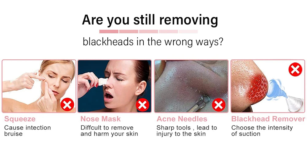 Peicon profesjonalny ultradźwiękowy peeling do twarzy – głębokie oczyszczanie i złuszczanie