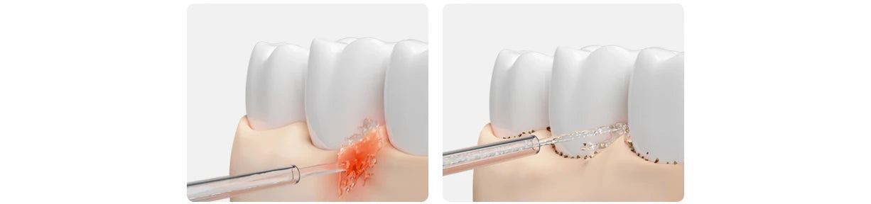 Mijia elektryczny irygator do jamy ustnej 2 – ultrasoniczny floser dentystyczny